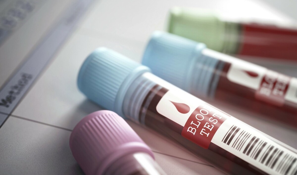 长期吃瑞舒伐他汀钙片应注意什么,服用阿托伐他汀后要注意什么饮食