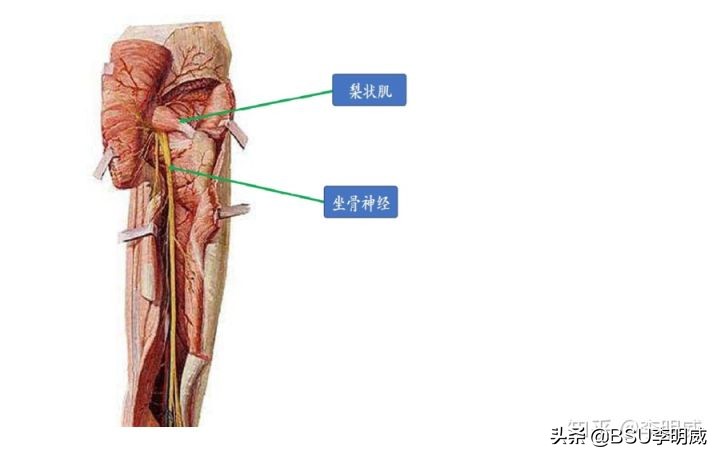 腰间盘突出腿麻恢复的最佳方法,腰间盘突出恢复最快的方法