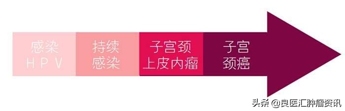 宫颈癌筛查要做哪几样,宫颈癌筛查要做哪几项怎么做
