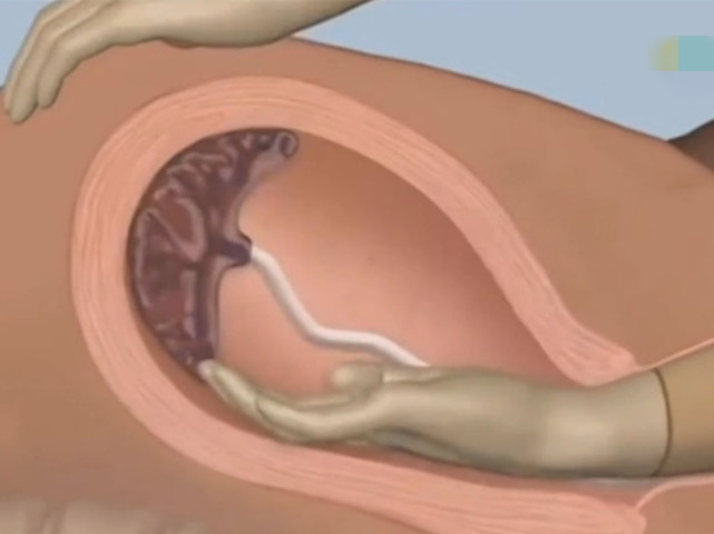 怀孕生孩子，孕妈经常会遇到10个尴尬的场景，你遇到过几个呢