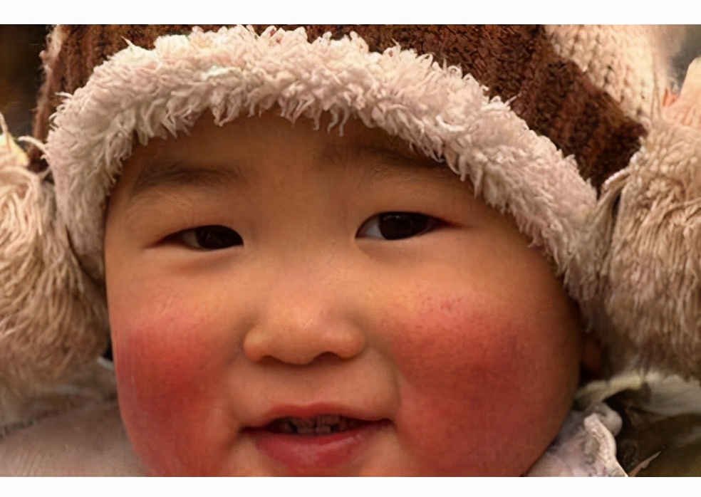 冬季如何给宝宝护肤记住这几点,宝宝冬季能抹什么护肤品