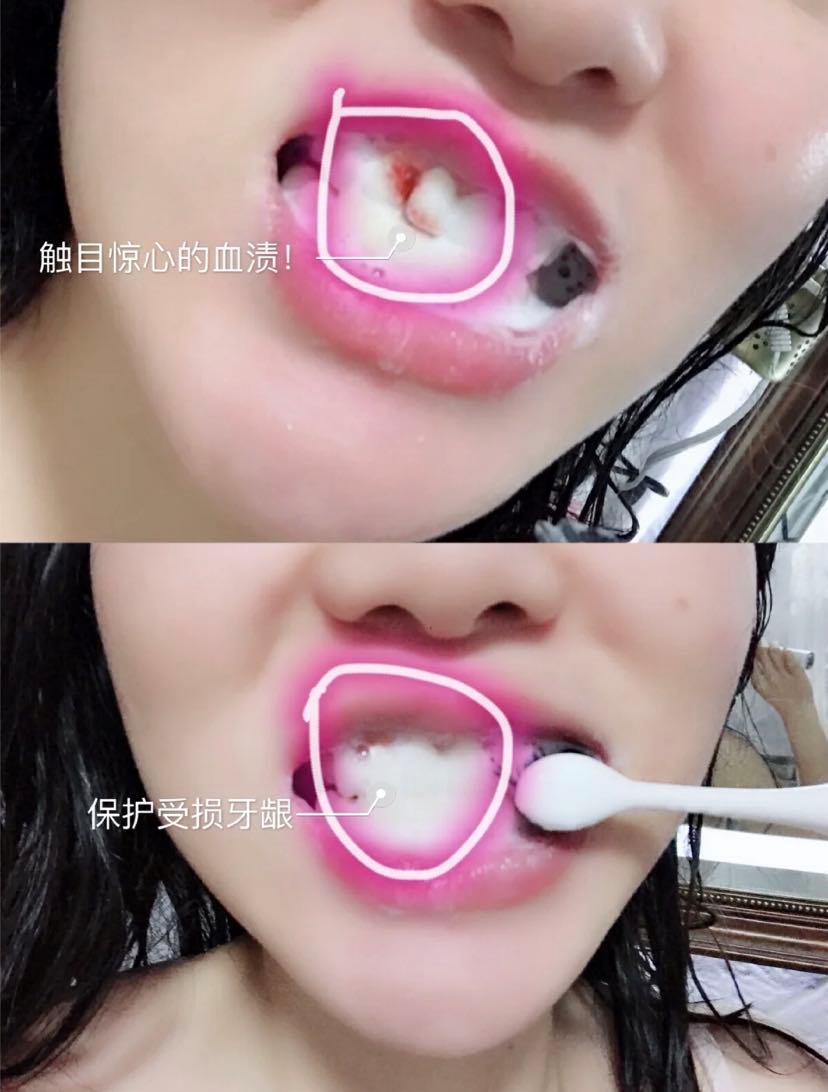 牙黄口臭怎么办用什么牙膏,黄牙口臭解决方法牙膏