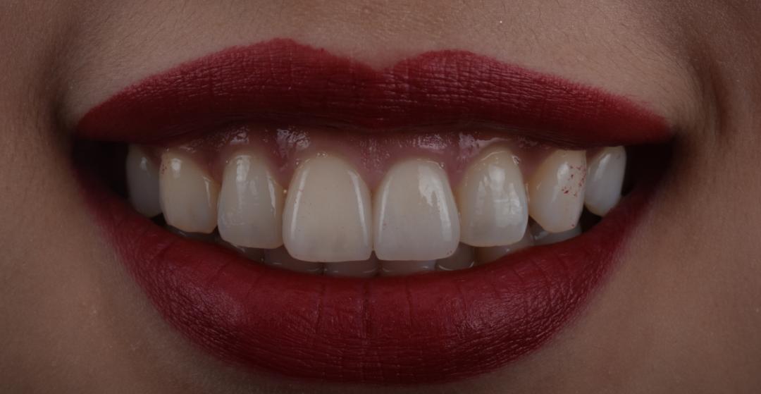 美白牙膏去牙黄真实有效测评,美白牙膏真实测评护牙效果