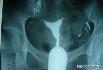 于萍主任青岛,青岛妇儿输卵管造影怎么样