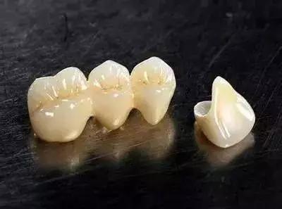 牙齿折断不及时治疗会怎样,牙齿折断了只剩根部