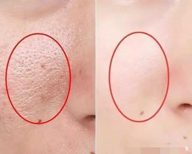 明星都是用什么牌子的美容仪,半个娱乐圈都用美容仪吗