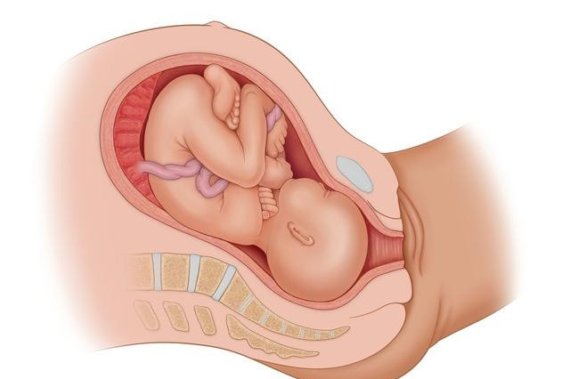 《仁和孕事》怀孕第三十周之如何让选择分娩方式