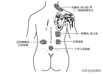 肚子痛常见是哪里的问题,肚子疼表现症状有哪些