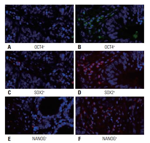 确诊直肠癌是否需做肿瘤基因检测,肿瘤标志物能否发现肠癌
