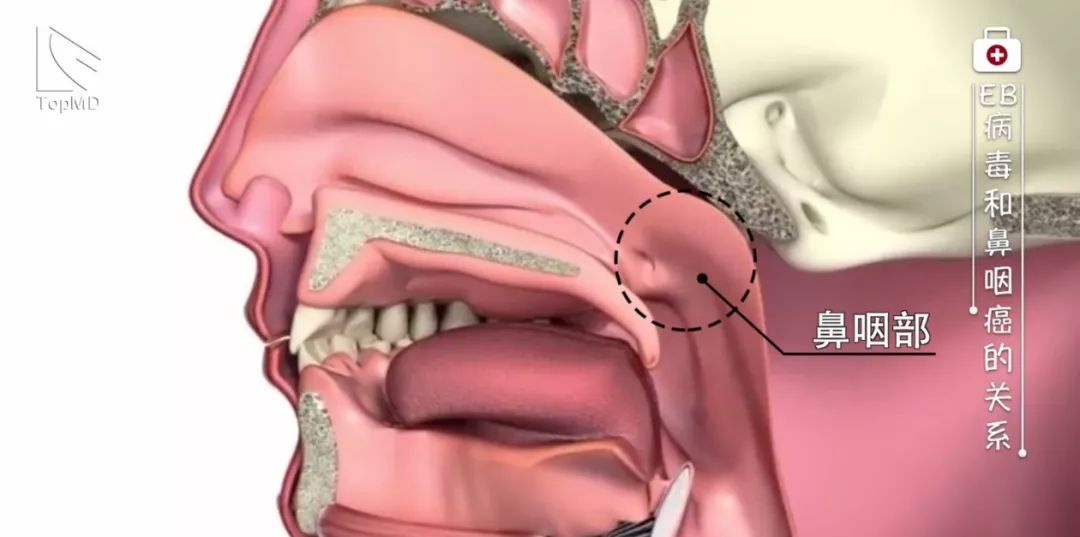 eb病毒阳性是不是一定会得癌症,eb病毒感染多久会变癌