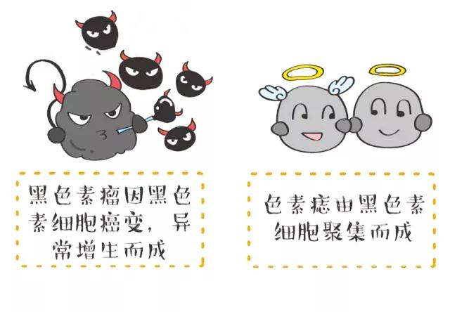 中心医院胎记用激光去除疼吗,中心医院祛胎记