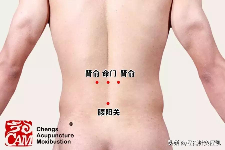 腰疼寒气重外敷处方,受寒腰痛可以拔火罐