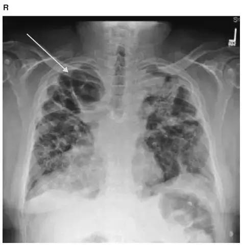 胸部影像解剖图谱书,胸部断层图谱