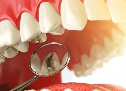 牙上有黑黑的东西，又丑又臭，给你2个解决方法