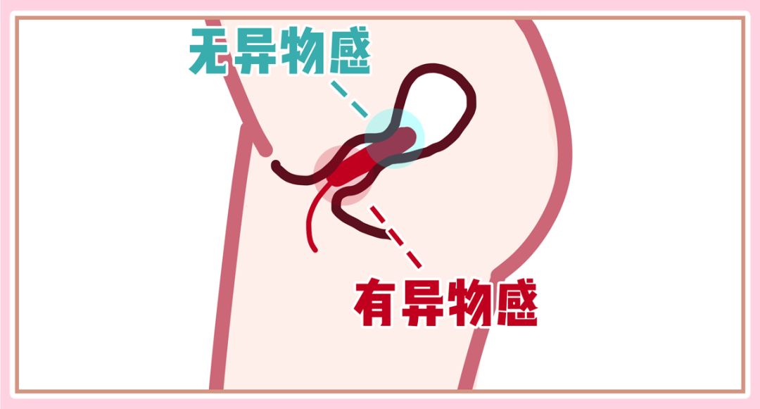 别怕!卫生棉条比你想的好用多了