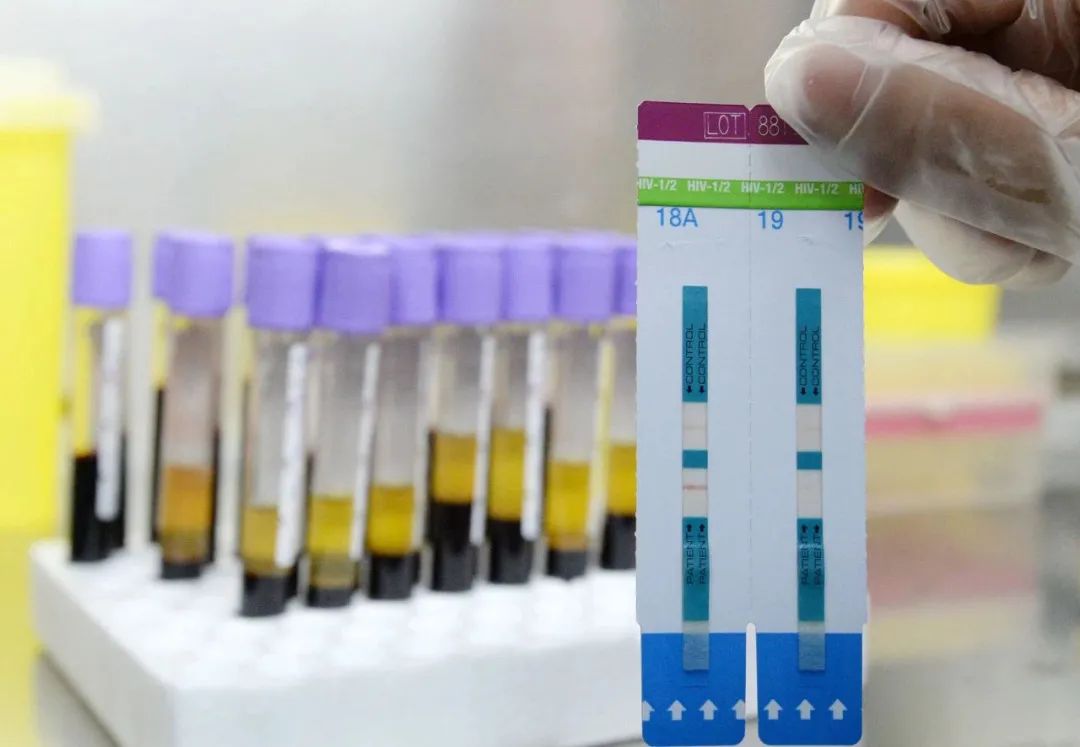 我们与病魔的距离,我们与艾滋的距离