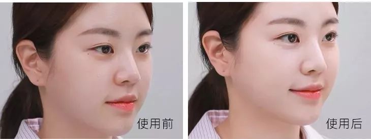 夏天肤色黑怎么办,黑黄暗沉肤色改善