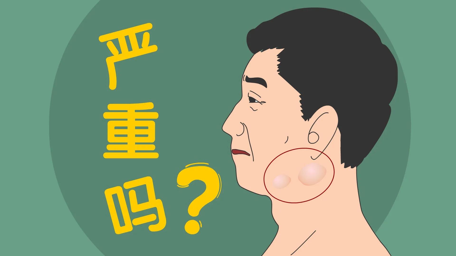 颈部淋巴结肿大恶性彩超报告单,颈部淋巴结肿大恶性会危及生命吗