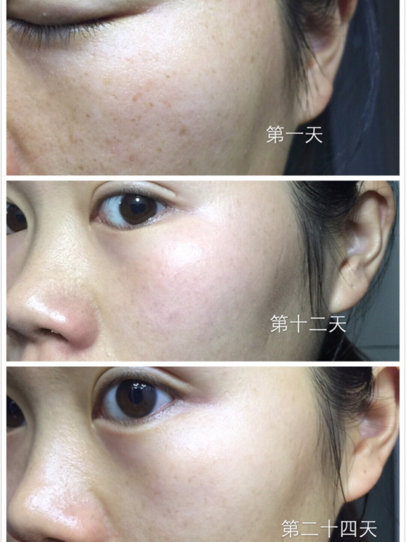 「*今条头日**」护肤的步骤是什么？擦护肤品的正确步骤是什么？