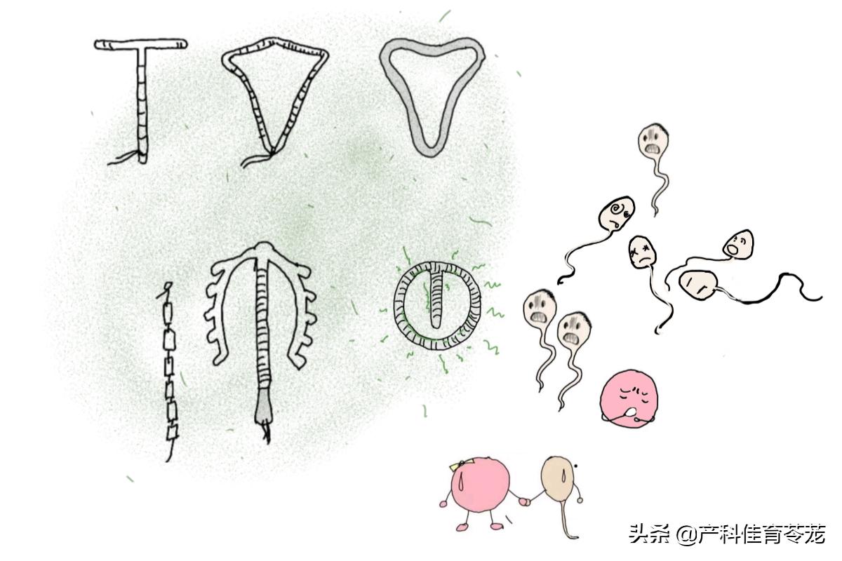 靠谱十大避孕方式,夫妻用得最多的避孕方法