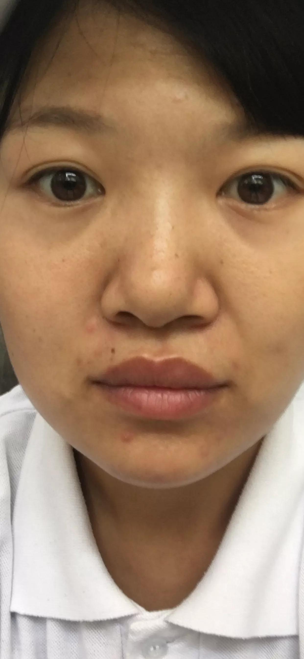 skii神仙水一般多少钱一瓶,为何sk-ii神仙水现在这么便宜