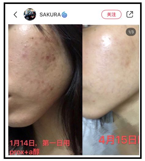 olay和欧莱雅哪个好性价比高,欧莱雅和olay哪个高档一点