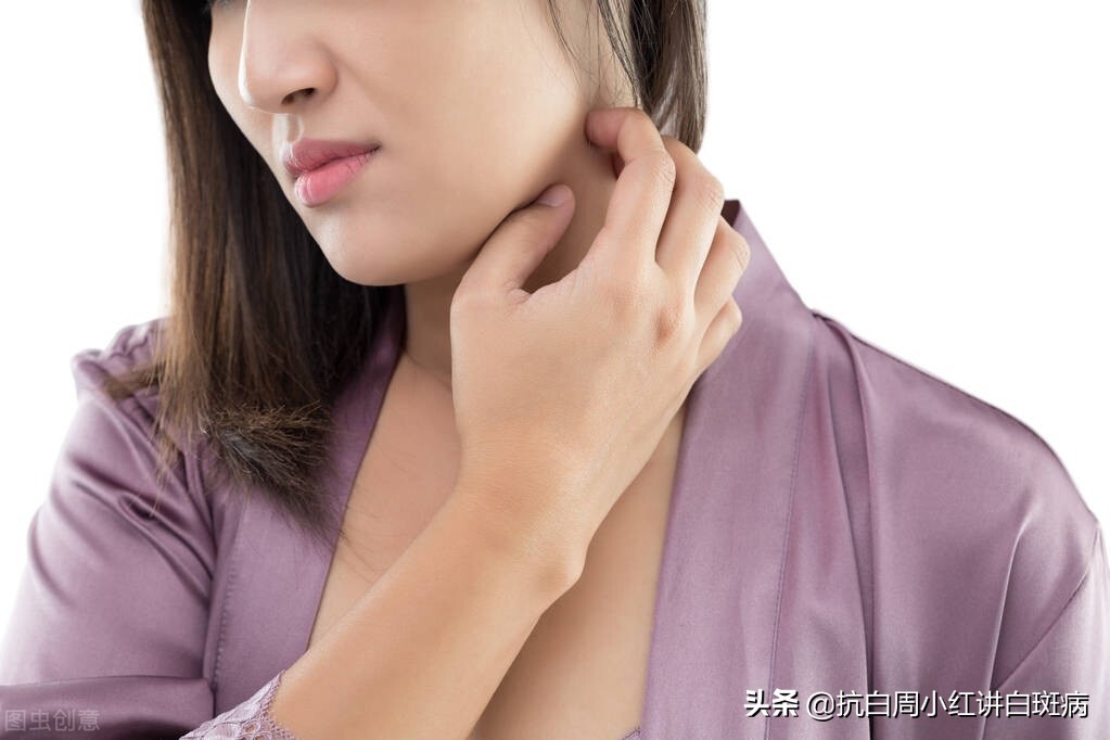 白癜风的白斑一般的症状是什么呢,白癜风的白斑一般的症状是什么