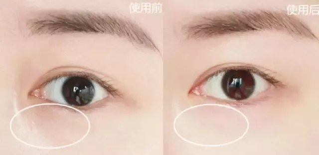 眼霜排行榜10强平价祛细纹脂肪粒,去眼袋公认最好用10大平价眼霜