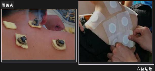 仙游县医院三伏贴预约,仙游县中医理疗馆