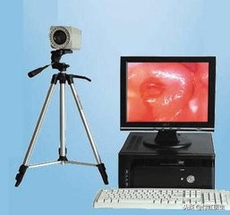 孕期tct检查是什么意思,tct异常是什么原因引起的