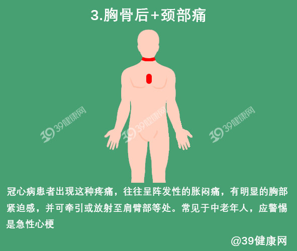 有心肌缺血的症状但是查不出问题,心肌缺血的症状大家一定要注意