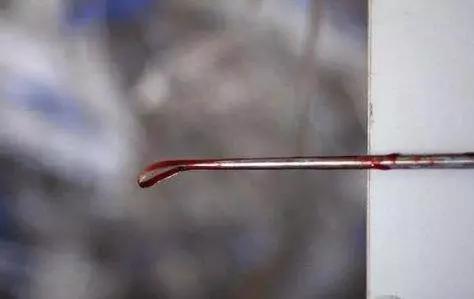 无痛人流手术后注意事项和禁忌,来看看做人流手术的最佳时间