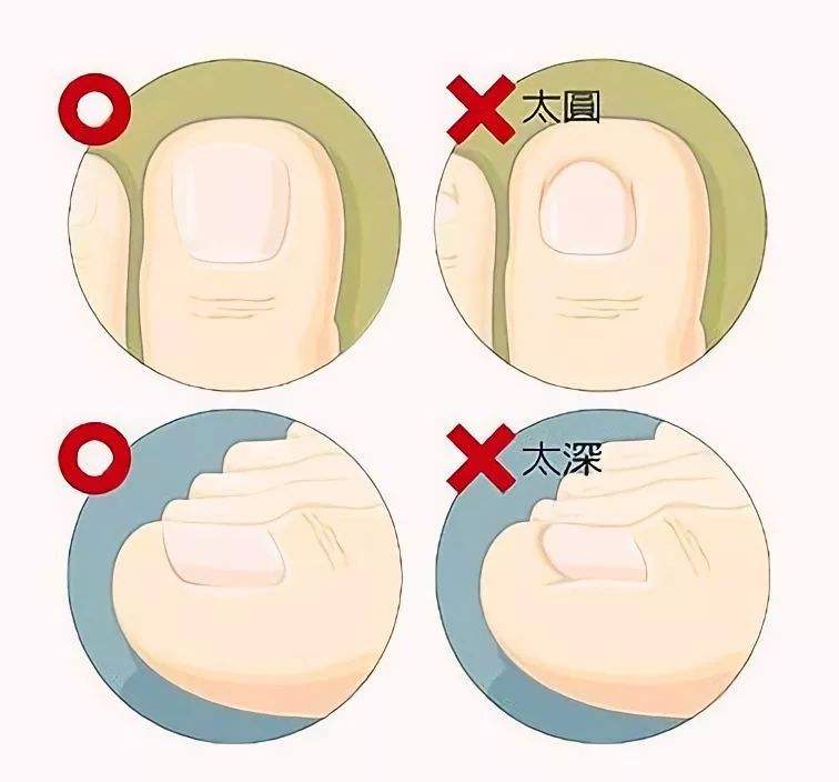 瀛欎开鏉ㄥ箓鍚存槙绉佷笅鍏崇郴,鑹捐崏娉¤剼鑽寘鍚存槙瀛欎开鍚屾