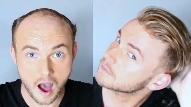 这么吃，最容易掉头发....