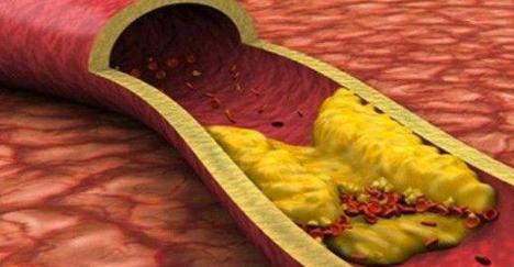 吃羊肉上火了吃什么药降火最快,吃羊肉热气上火怎么解毒