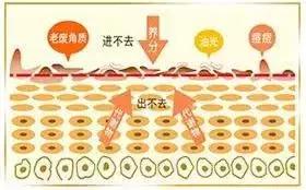 痘痘闭口全消散一周测试有效,28天祛痘