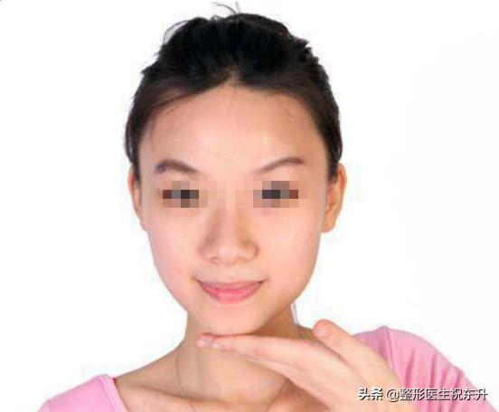 每天坚持90秒一周消除双下巴,去双下巴最有效的动作