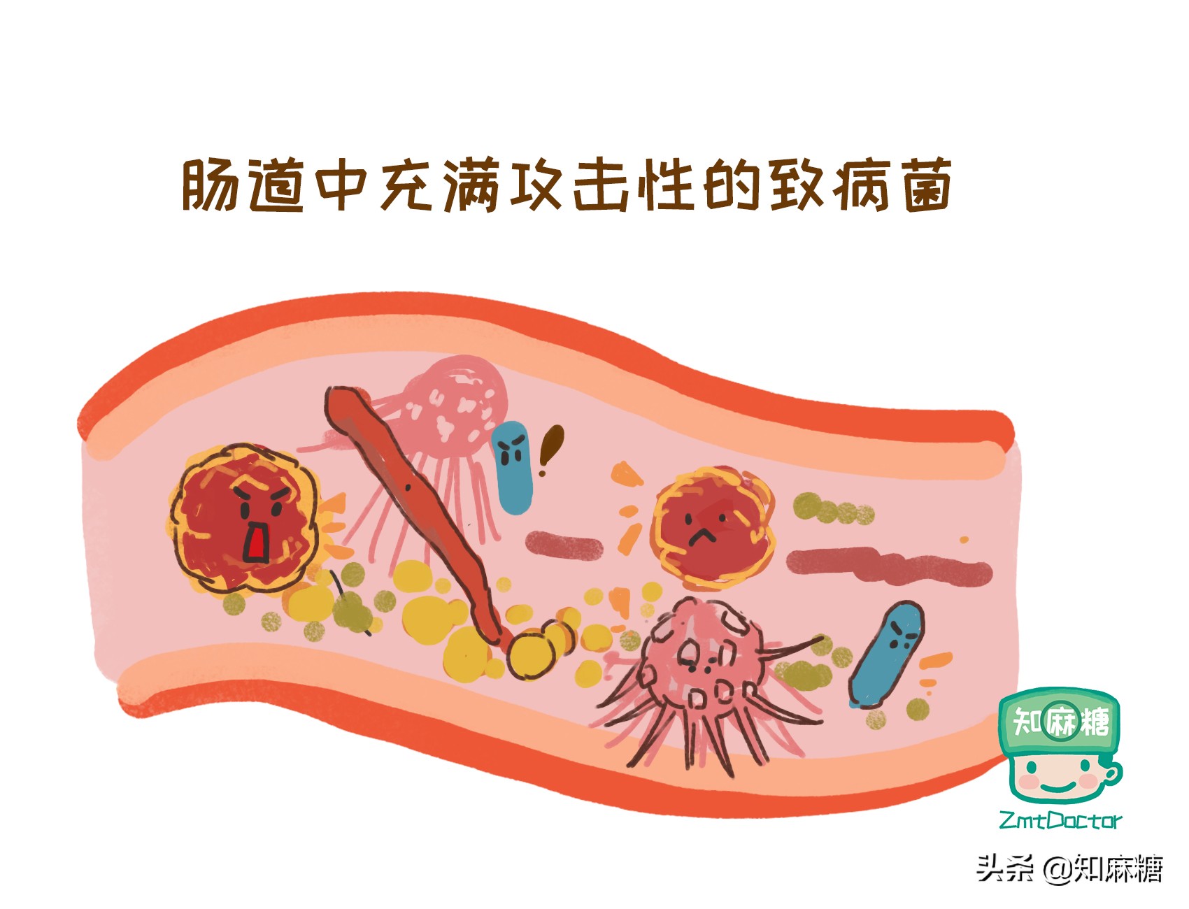 来自新生儿的控诉：剖宫产又多了一宗罪