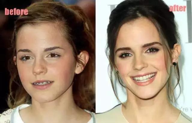 颜值不够美颜来凑系列,颜值不够医美来凑