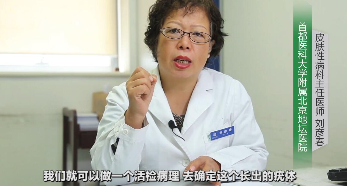 尖锐性湿疣要检查什么项目,尖锐性湿疣需要做些什么检查