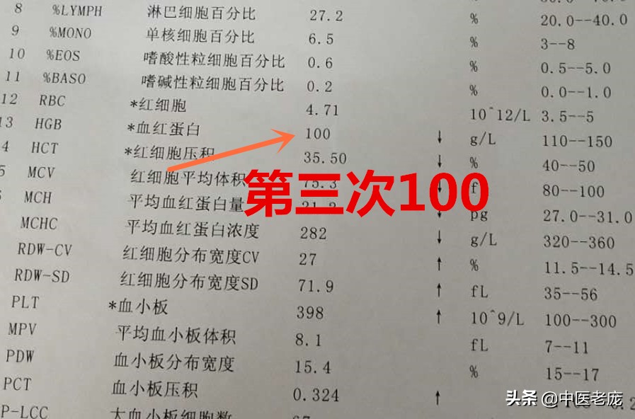 贫血五六年吃药多长时间能好,缺铁性贫血看中医能好吗