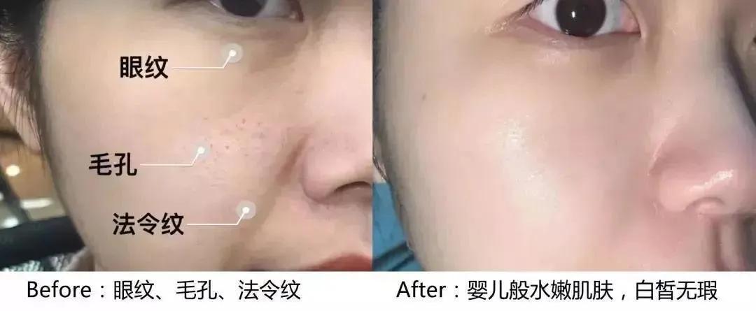 抗初老面膜平价推荐,抗初老补水面膜