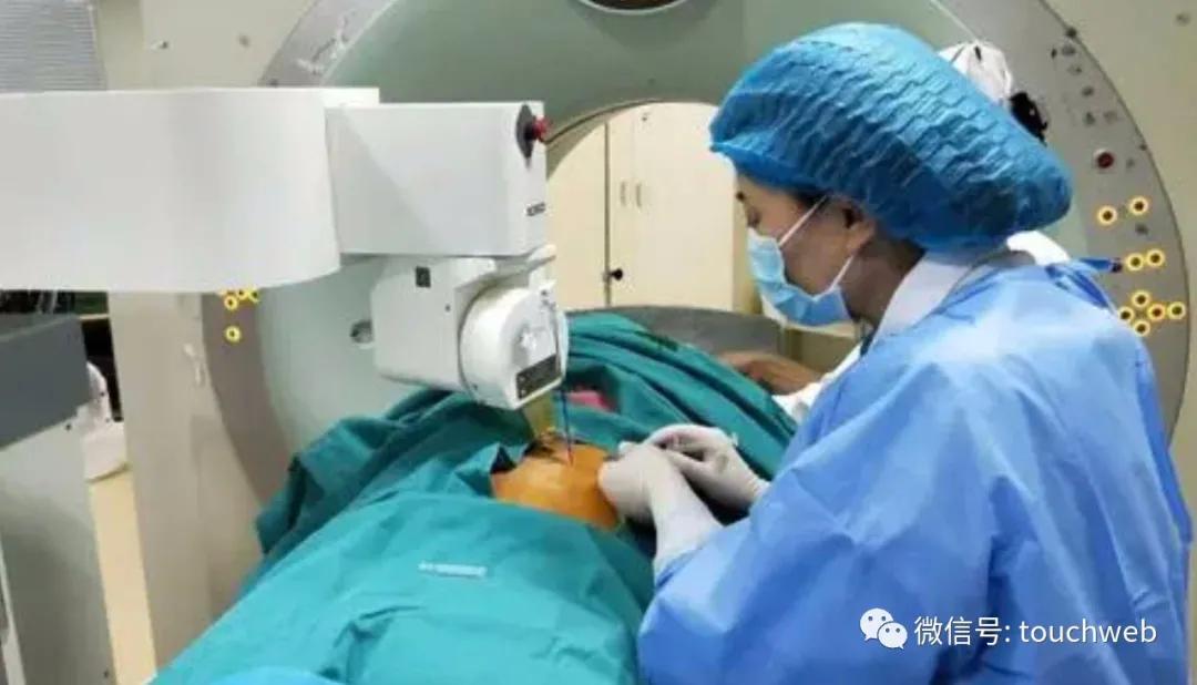 百德医疗微波消融设备,百德医疗A轮融资