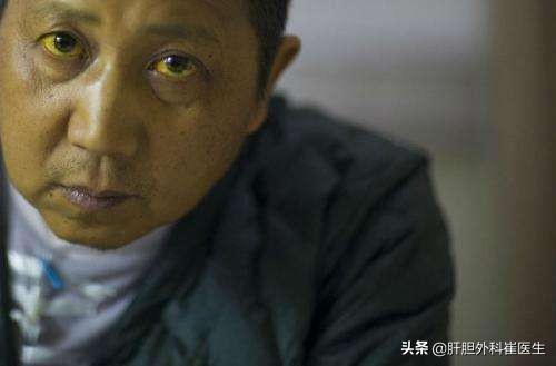 体检查出胆红素高是怎么回事,体检报告胆红素偏高的原因及危害