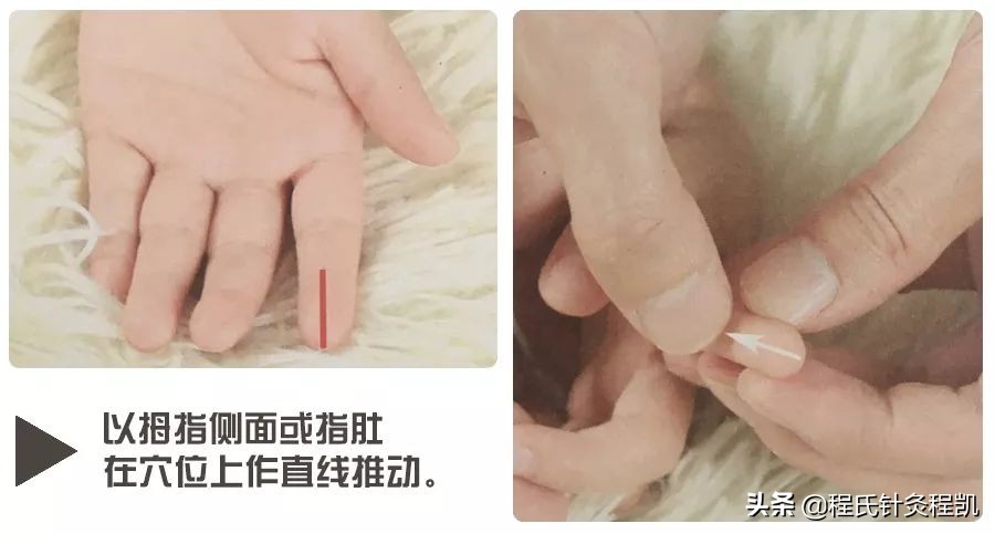 秋季孩子身上起荨麻疹怎么办,秋季小孩出麻疹