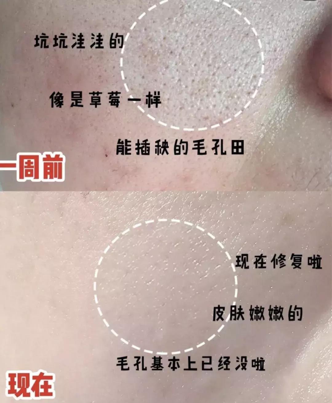 一到晚上皮肤暗沉发黄,一到下午皮肤暗沉