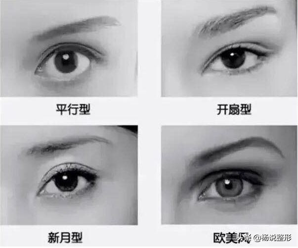 整形医生科普割双眼皮必看攻略,割双眼皮一定好看吗