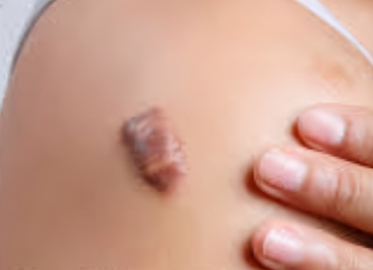 受伤的伤疤愈合后为什么还痛,好了伤疤忘了疼为什么