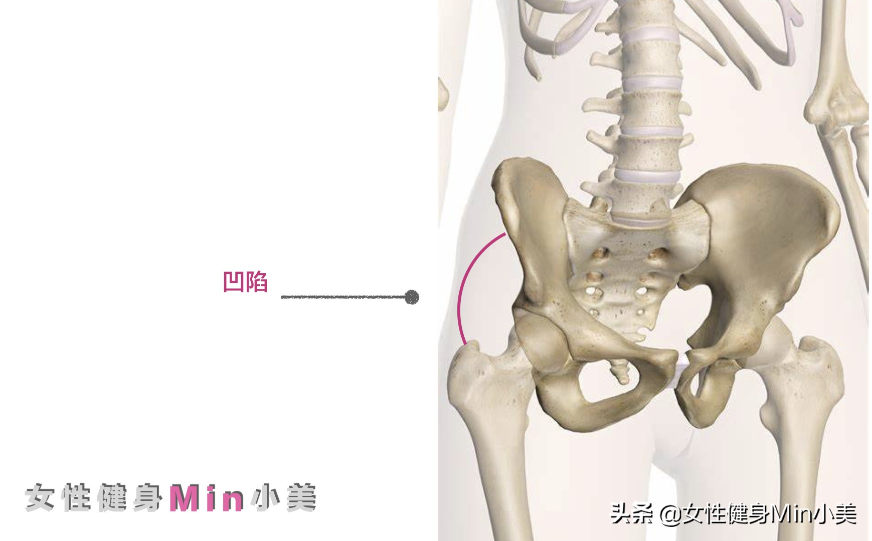 臀中肌变大是怎么回事,臀凹陷不能全是练臀中肌解决