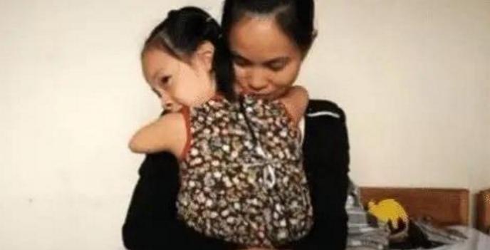 严重脑瘫神童,中国天才少年脑瘫